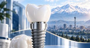 راهنمای انتخاب ایمپلنت اشترومن در کرج؛ از ارزیابی استخوان تا تحویل روکش
