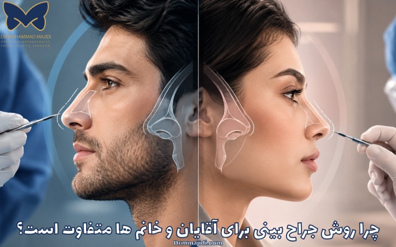 چرا روش جراح بینی برای آقایان و خانم ها متفاوت است؟